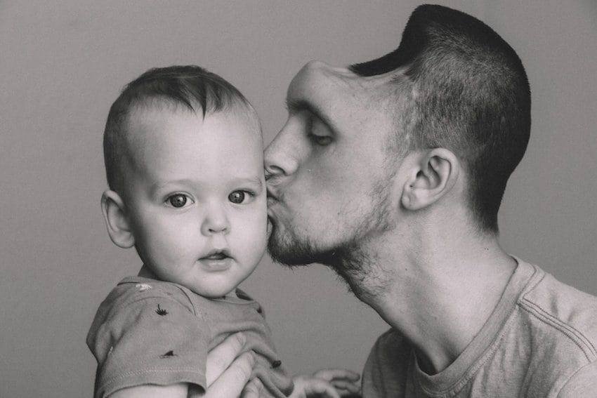 California dad loses part of his skull after drinking too many energy drinks