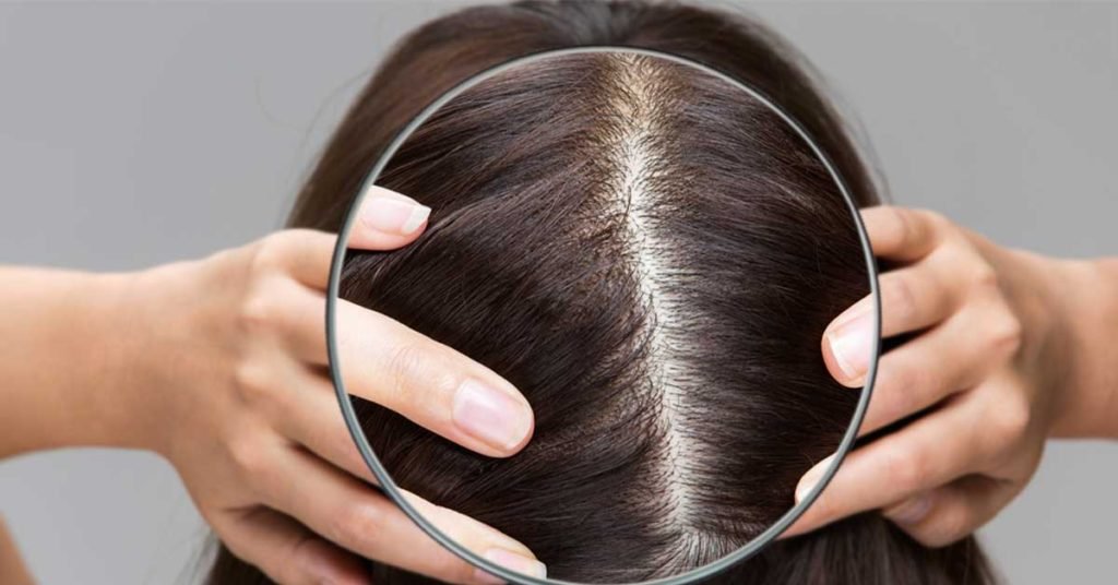 Complete guide on how to take care of your scalp for shiny hair