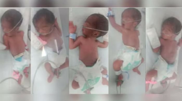 Karachi woman gives birth to quintuplets