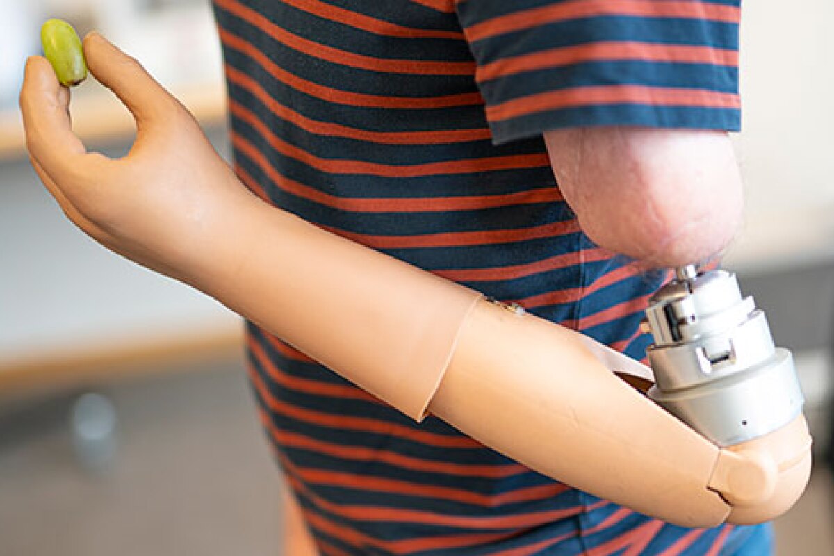 Palestinian kids get prosthetic arms from Pakistani startup