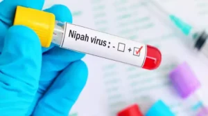 Nipah Virus Cases in India Trigger Regional Alert, Symptoms and Risks Explained