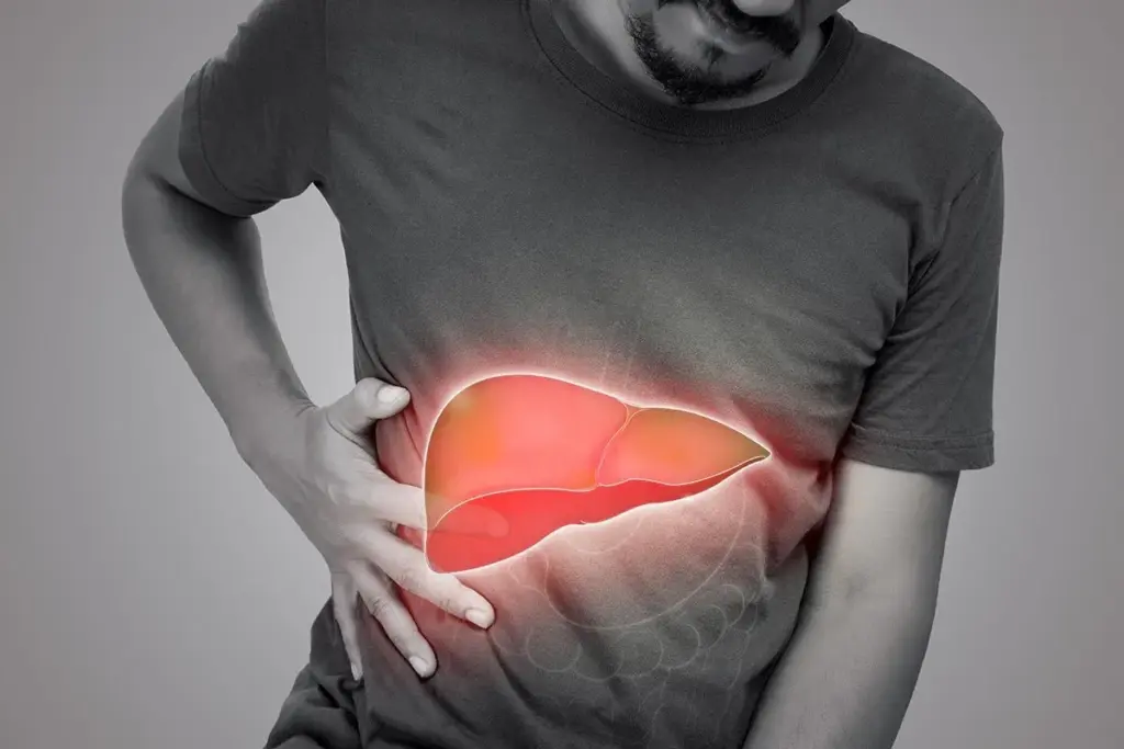 World Liver Day: PMA Warns of Rising Hepatitis and Liver Disease Crisis in Pakistan