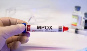 Monkeypox Cases Rise in Lahore as New Infections Push Total to 30 in 2026