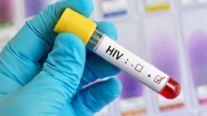 Pakistan Loses Contact with 20,000 HIV Patients, Parliament Raises Alarm