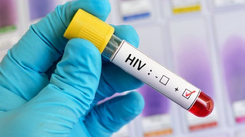 Pakistan Loses Contact with 20,000 HIV Patients, Parliament Raises Alarm