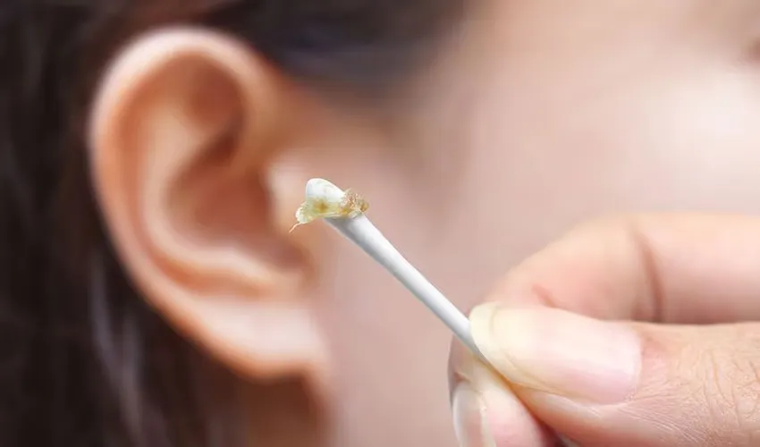 What Your Earwax Colour Says About Your Health, Doctors Explain