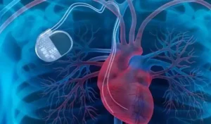 China Creates First Lab-Grown Heart Pacemaker Node Breakthrough