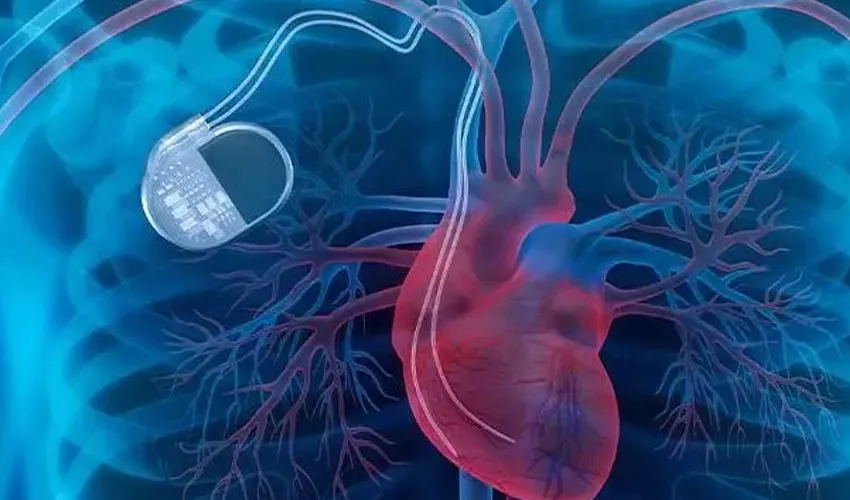 China Creates First Lab-Grown Heart Pacemaker Node Breakthrough