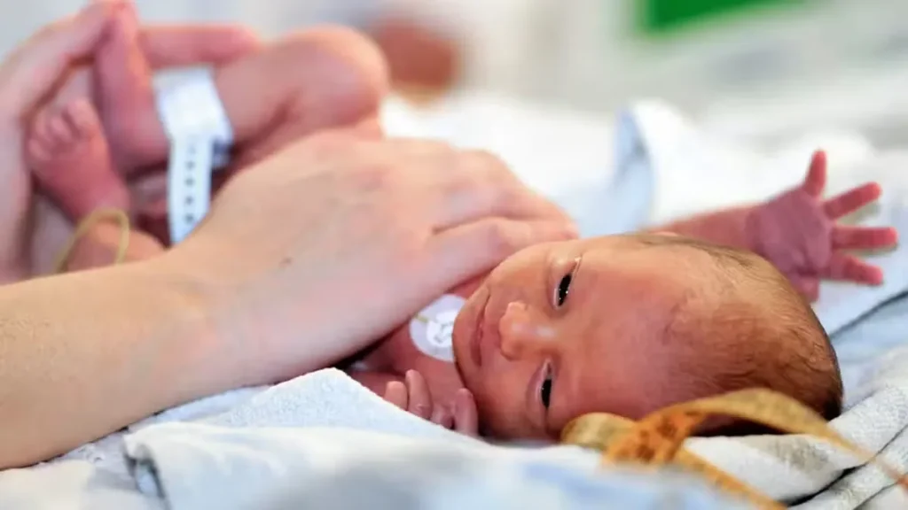 Doctors Warn of ROP Risk Among Premature Babies in Pakistan