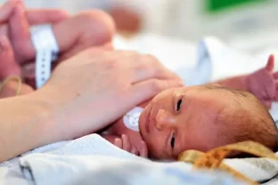 Doctors Warn of ROP Risk Among Premature Babies in Pakistan